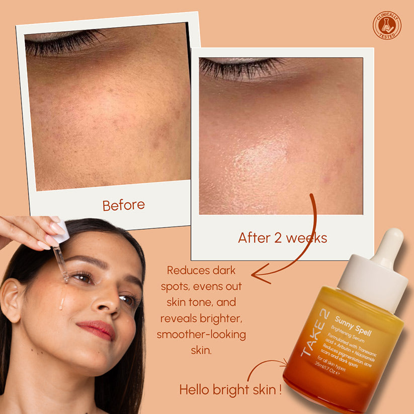 Sunny Spell Brightening Serum
